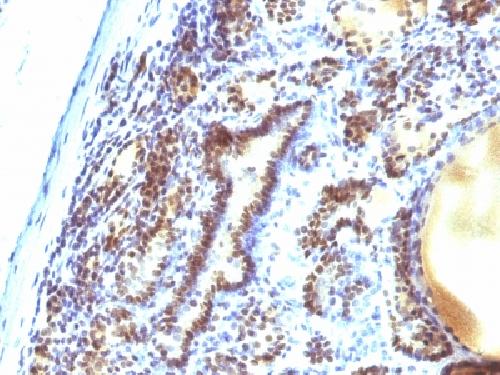 MAP3K1 (Mitogen-Activated Protein Kinase Kinase Kinase 1) Antibody