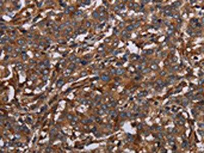 MAP3K11 Antibody