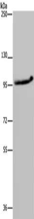 MAP3K11 Antibody