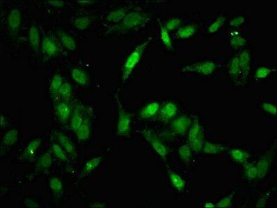 MAP3K11 Antibody