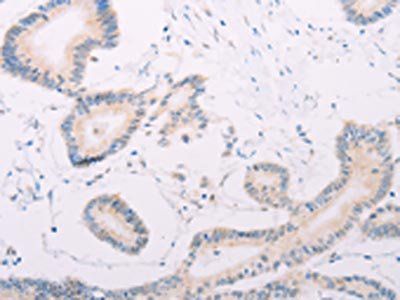 MAP3K12 Antibody