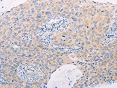 MAP3K12 Antibody