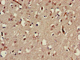 MAP3K13 Antibody