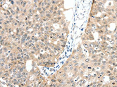 MAP3K14 Antibody