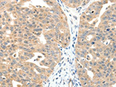 MAP3K14 Antibody