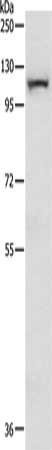 MAP3K14 Antibody