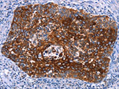 MAP3K2 Antibody