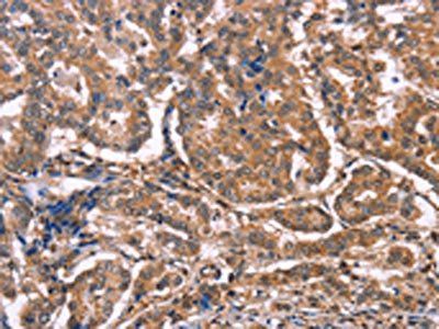 MAP3K2 Antibody