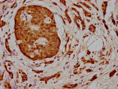 MAP3K2 Antibody