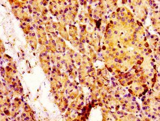 MAP3K4 Antibody