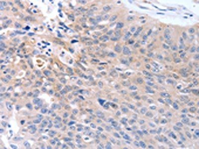 MAP3K4 Antibody