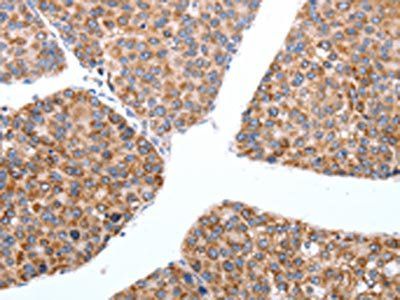MAP3K4 Antibody