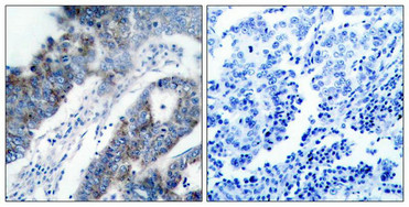 MAP3K5 (Ab-83) Antibody