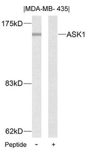 MAP3K5 (Ab-83) Antibody