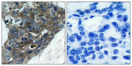 MAP3K5 (Ab-966) Antibody