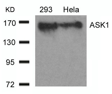 MAP3K5 (Ab-966) Antibody
