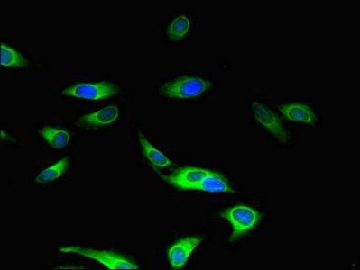 MAP3K5 Antibody