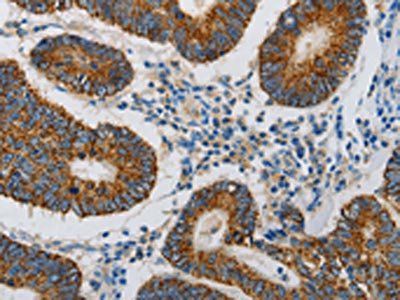 MAP3K5 Antibody