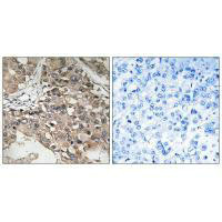 MAP3K7 (Ab-187) Antibody