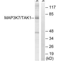 MAP3K7 (Ab-187) Antibody