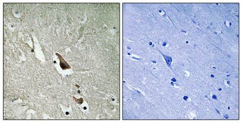 MAP3K7 (Phospho-Ser439) Antibody