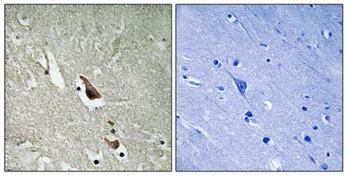 MAP3K7 (phospho-Ser439) antibody