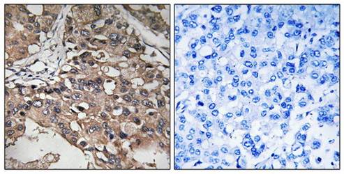 MAP3K7 (Ab-187) Antibody