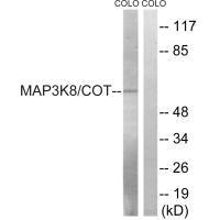 MAP3K8 Antibody