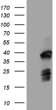 MAP3K8 Antibody