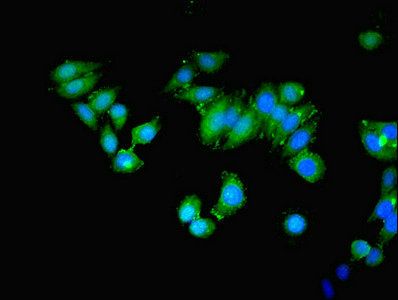 MAP3K8 Antibody