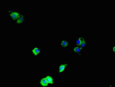 MAP3K8 Antibody
