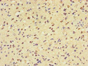 MAP3K8 Antibody