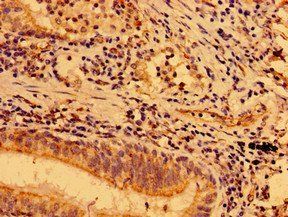 MAP3K9 Antibody
