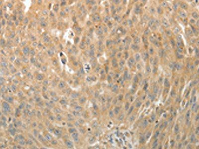 MAP4 Antibody