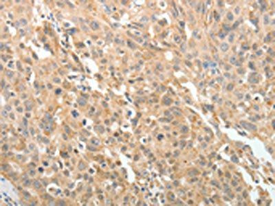 MAP4 Antibody