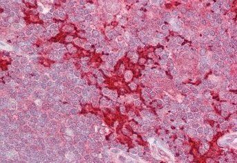 Goat anti-HPK1 / MAP4K1 Antibody