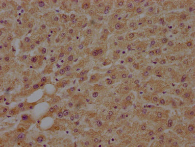 MAP4K4 Antibody