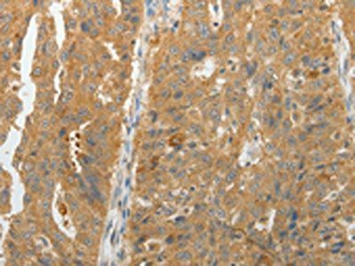 MAP4K5 Antibody