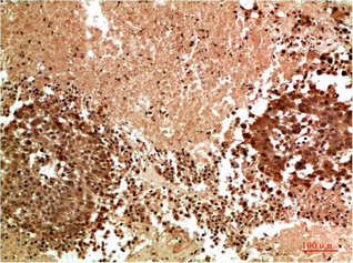 MAPK10 Antibody
