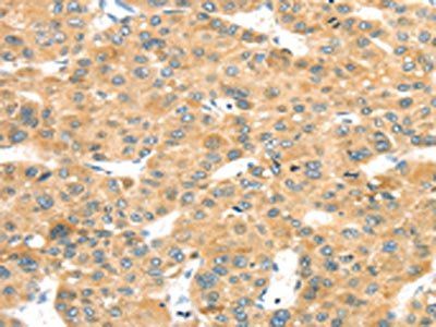 MAPK12 Antibody