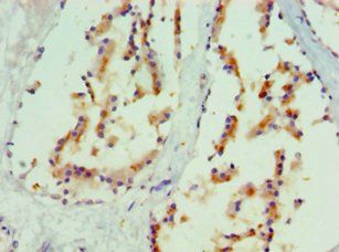 MAPK13 Antibody