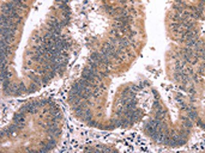 MAPK13 Antibody