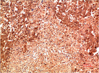 MAPK14 Monoclonal Antibody