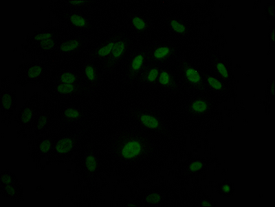 MAPK14 Recombinant Monoclonal Antibody