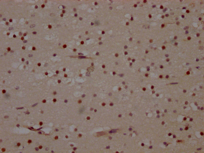 MAPK14 Recombinant Monoclonal Antibody