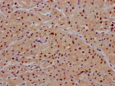MAPK14 Recombinant Monoclonal Antibody