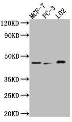 MAPK14 Recombinant Monoclonal Antibody