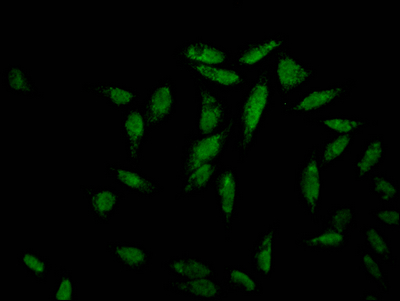 MAPK14 Recombinant Monoclonal Antibody