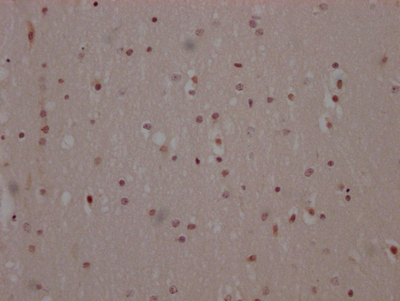 MAPK14 Recombinant Monoclonal Antibody
