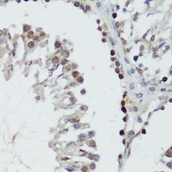 MAPK14 (Phospho-Y182) antibody